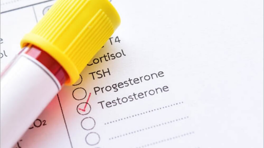 testosteron testi